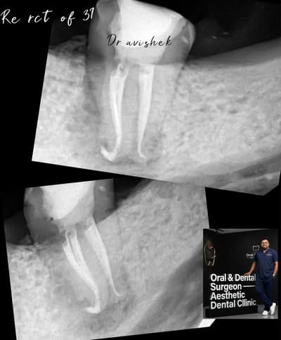 care your tooth ....Oral health is far more than just a beautiful  smile ..it is the gate way of your over all physical well - being
